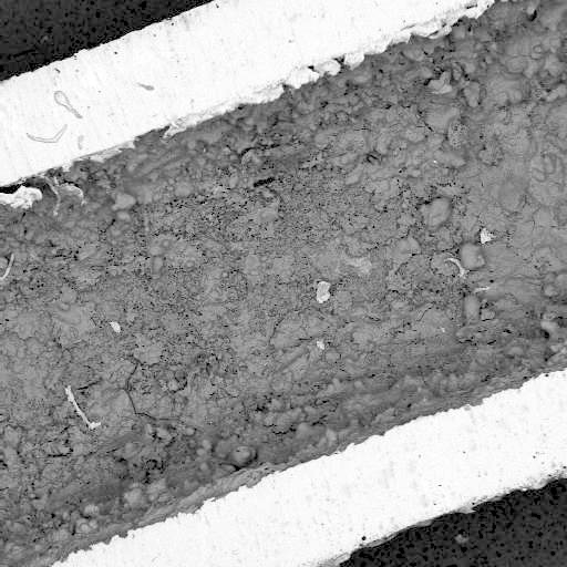 Preview image for Case 1475