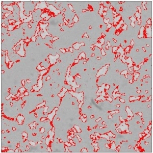 Gold embrittlement of a solder joint. The digitally enhanced "red" pixels correspond to AuSn4 intermetallic compound, lighter areas are Pb, and darker grey is Sn.