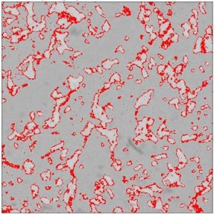 Gold embrittlement of a solder joint. The digitally enhanced "red" pixels correspond to AuSn4 intermetallic compound, lighter areas are Pb, and darker grey is Sn.